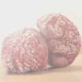 brain